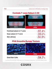 COSRX Azelaic Acid 10 B5 Redness Soothing Cream
